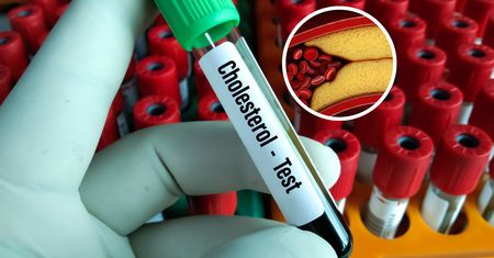 Wypłukuje cholesterol z tętnic. "Ostatnia deska ratunku"