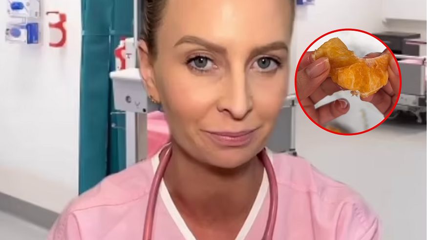 Uwaga na mandarynki. Bardzo łatwo się nimi zakrztusić