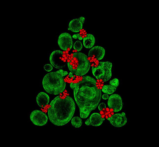 Wzrost tkanki chrząstkowej w laboratorium wykorzystującym kościowe komórki macierzyste (włókna kolagenowe zielone i tłuszczowe osady czerwone) / Powiększenie 20x włókna kolagenowe; 40x tłuszczowe osady