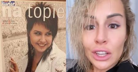 Blanka Lipińska pokazała, jak wyglądał jej zgryz 12 LAT TEMU! "ZĘBY ZMIENIAJĄ TWARZ"