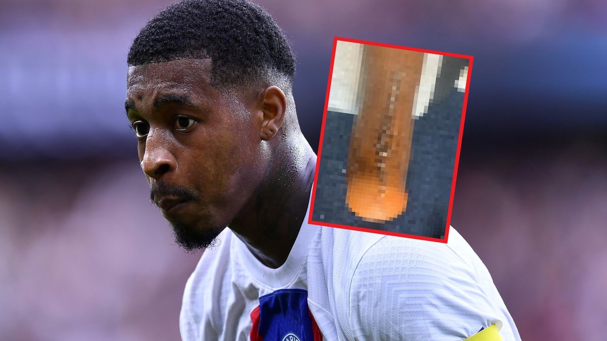 Na zdjęciu: Presnel Kimpembe