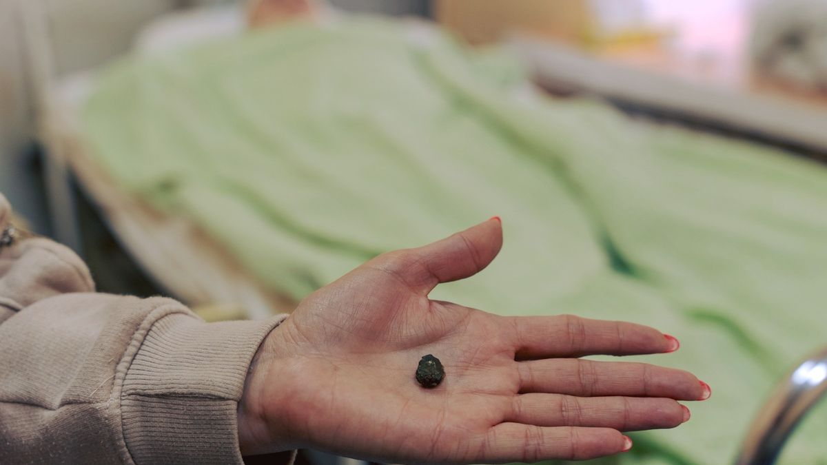 Utknęło jej w głowie. Lekarze uratowali dziewczynę 