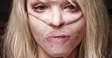 Katie Piper była więziona i oblana kwasem. Jak dziś wygląda jej życie?