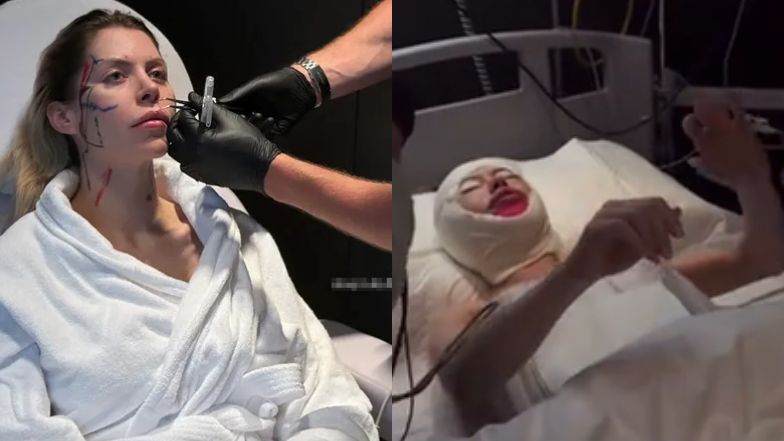 Tak Julia von Stein wygląda od razu po operacji