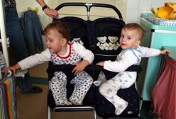 Rehabilitacja rozdzielonych sióstr syjamskich