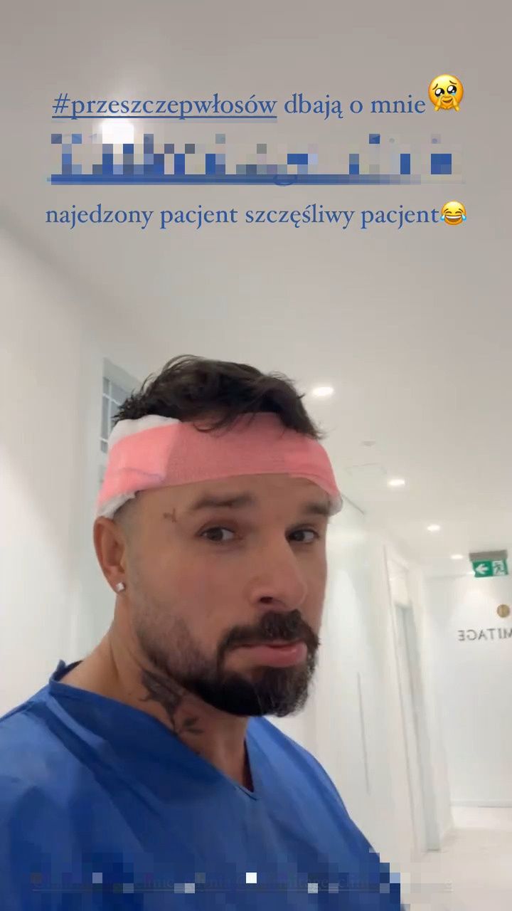Qczaj zrelacjonował przeszczep włosów