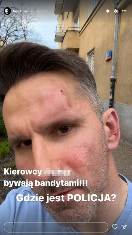 Marcin Bosak został pobity