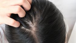 Swędzenie skóry głowy - nietypowy objaw chorej tarczycy