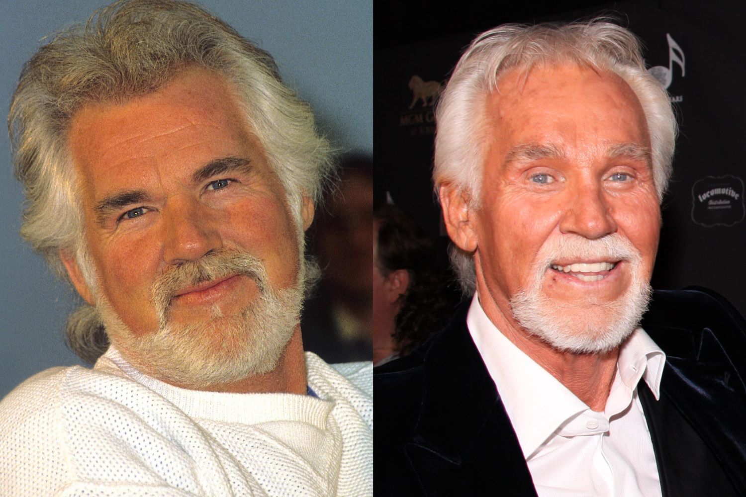 Kenny Rogers i operacje plastyczne