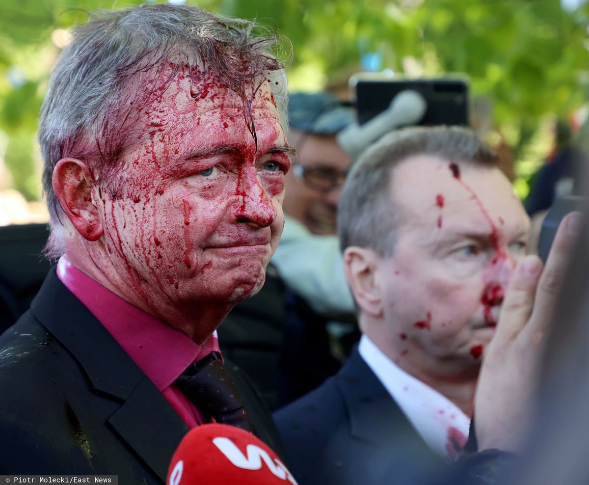 Oblanie farbą rosyjskiego ambasadora. Policja nie dopuściła się uchybień. East News, Warszawa, 