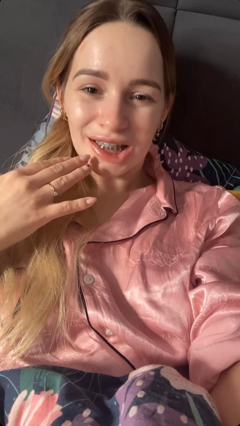 Ewelina Lisowska prezentuje, jak wygląda po zabiegu u dentysty