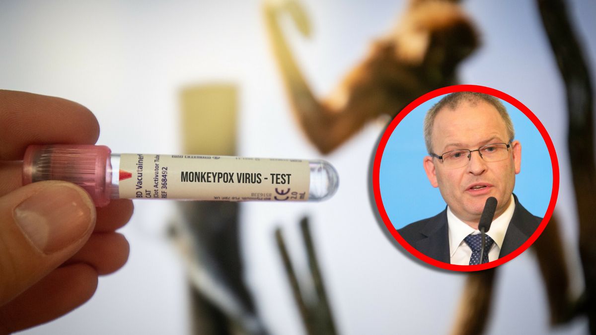 Trwają rozmowy o bezpośrednim zakupie od producenta leku na małpią ospę 