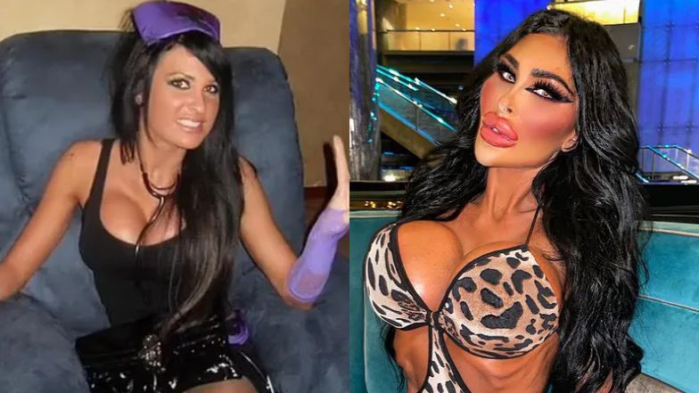 Wydała setki tysięcy na operacje plastyczne