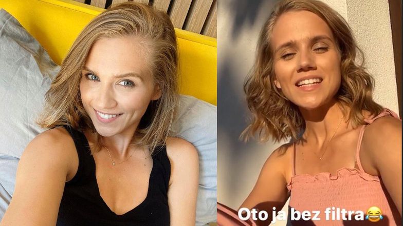 Bohaterska Agnieszka Kaczorowska walczy o samoakceptację, pokazując na Instagramie twarz bez makijażu: "Oto jestem, w pełnym słońcu, wybłyszczona na maksa" (FOTO)