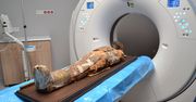 Lublin: Egipska mumia pod lupą radiologów