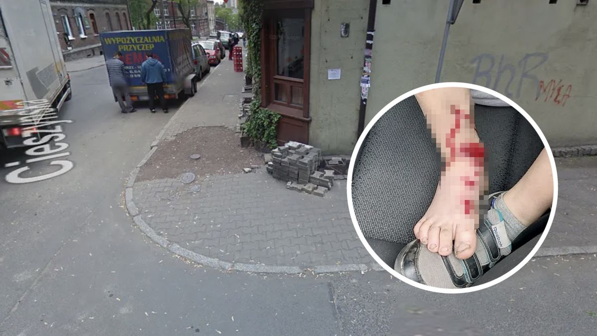 Przejechał po nodze dziecka