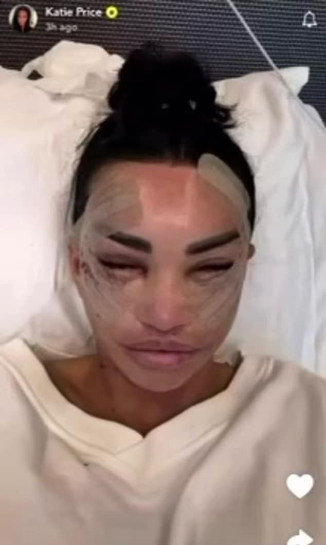 Katie Price wspomina poprzednie operacje w Turcji