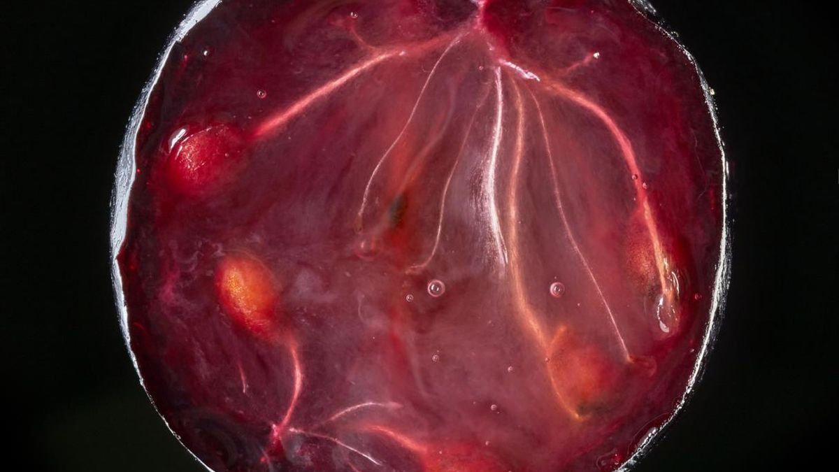 Cholesterol znika już po miesiącu. Ten olej działa cuda