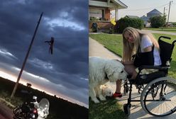 Straciła nogę w strasznym wypadku. Teraz świetnie wykorzystuje popularność