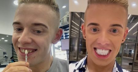 Brytyjczyk zrobił sobie transformację uśmiechu. Dentystka nie wytrzymała na widok jego "TURECKICH ZĘBÓW"... (WIDEO)
