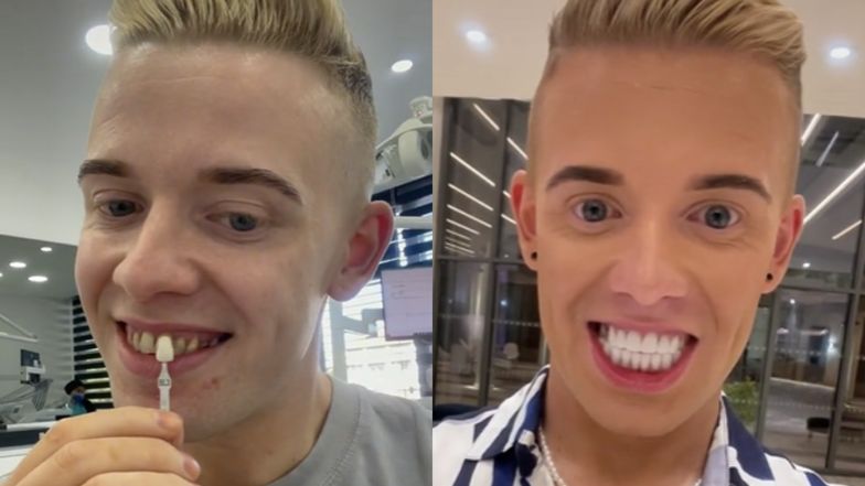 Brytyjczyk zrobił sobie transformację uśmiechu. Dentystka nie wytrzymała na widok jego "TURECKICH ZĘBÓW"... (WIDEO)
