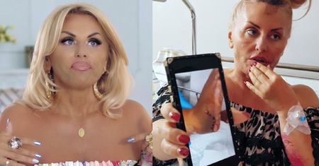 Dagmara Kaźmierska wspomina wypadek: "Stopa wisiała na skórze. Pięta zmiażdżona"