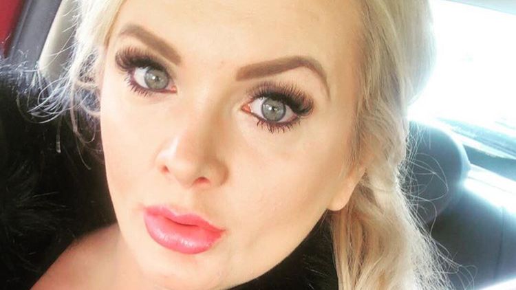 Karolina nie wstydzi się swoich operacji