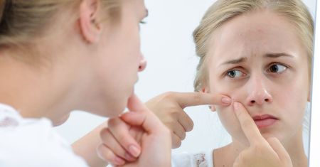 Domowe sposoby na trądzik - jak szybko pozbyć się pryszczy?