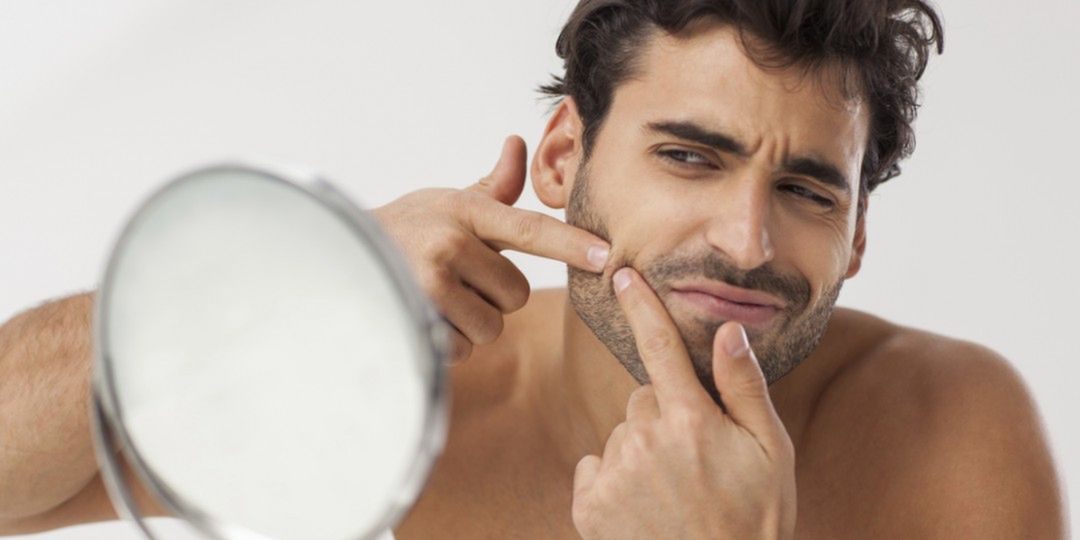 Męski trądzik – przyczyny powstawania i leczenie
