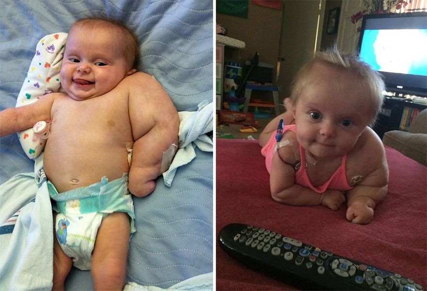 Scarlette walcząca z nowotworem - mięsakiem