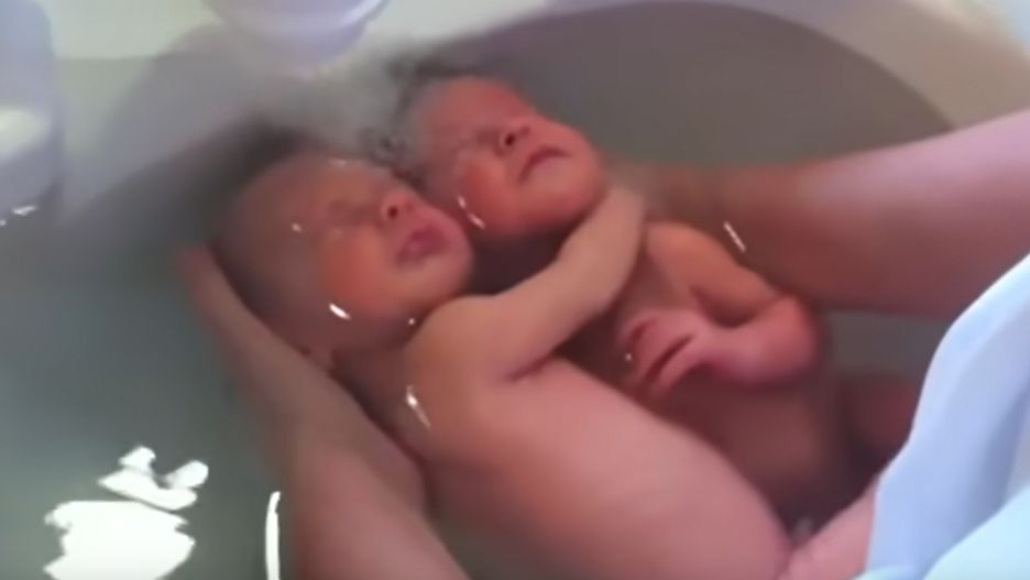 Polska położna nagrała bliźnięta. Filmik zrobił furorę w sieci