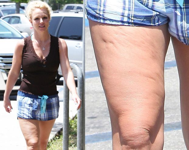 Cellulit Britney Spears... (ZDJĘCIA)