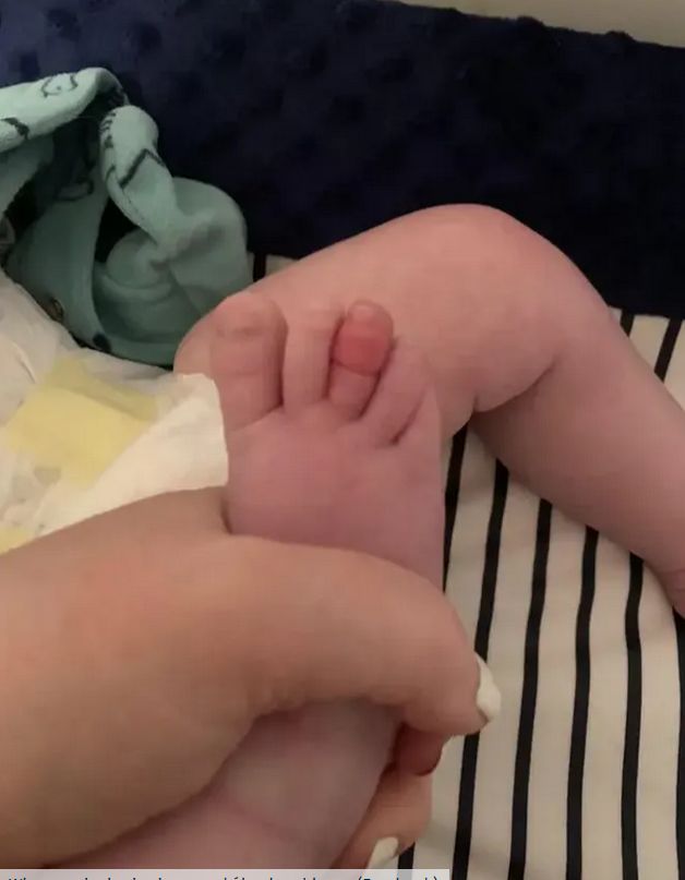 Palec dziecka Chelsi