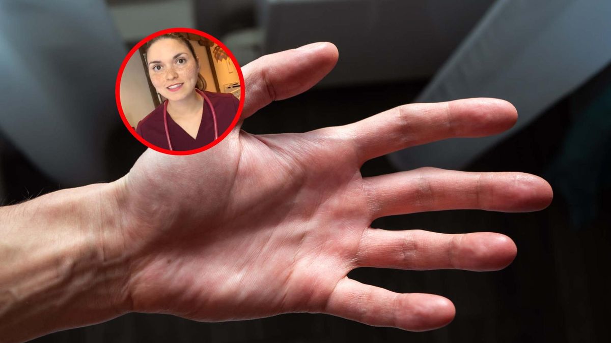 Reumatolożka: te choroby widać gołym okiem. Przyjrzyj się dłoniom