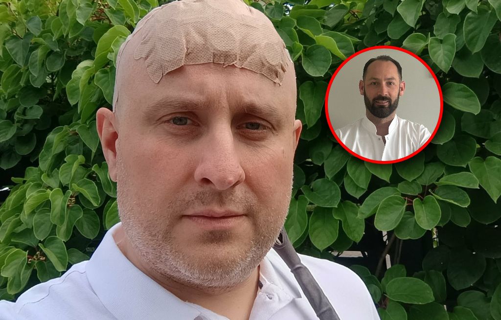 Tak leczą glejaka. Rewolucyjna terapia w Bydgoszczy
