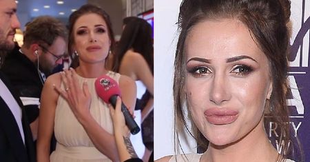 Opuchnięte wargi Elizy z "Warsaw Shore" przemówiły: "Poszłam w natural, nie mam tipsów"