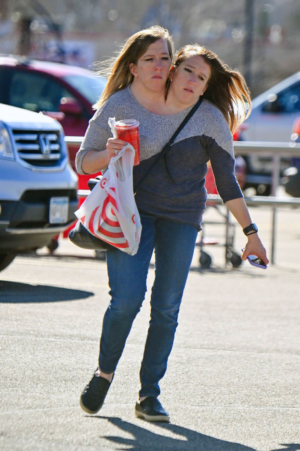 Abby i Brittany Hensel