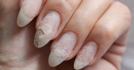 Slugging paznokci ratunkiem dla zniszczonej płytki. Koreanki go pokochały