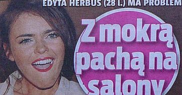Herbuś pokazała... plamę pod pachą