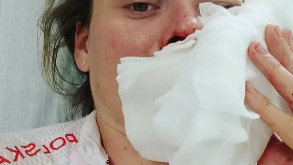 Polska olimpijka miała wypadek