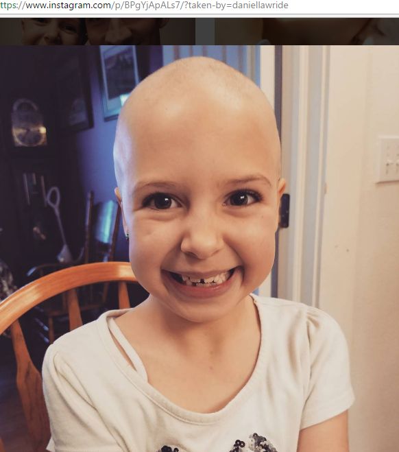 Gainessa Vinati Wride chora na łysienie plackowate