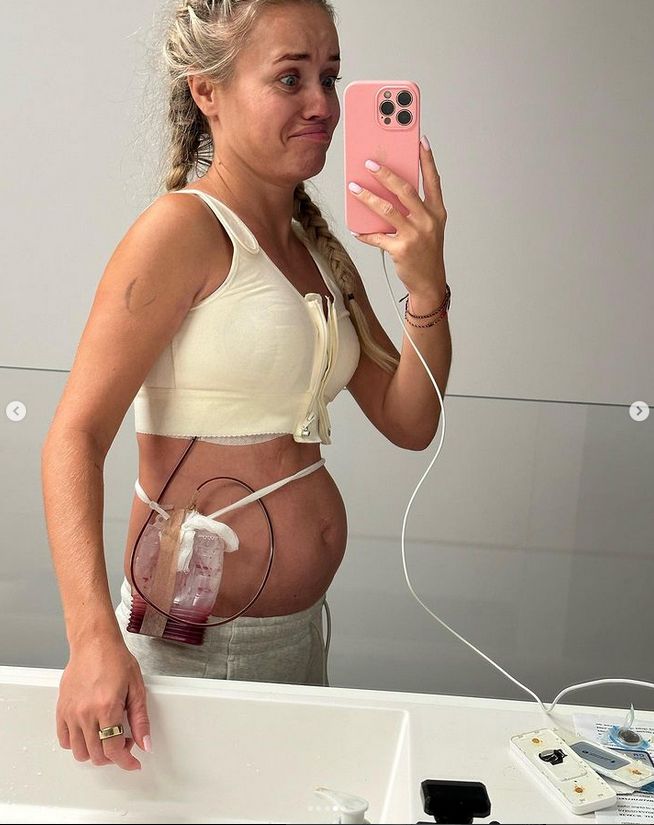 Anna Skura pokazała się po operacji piersi