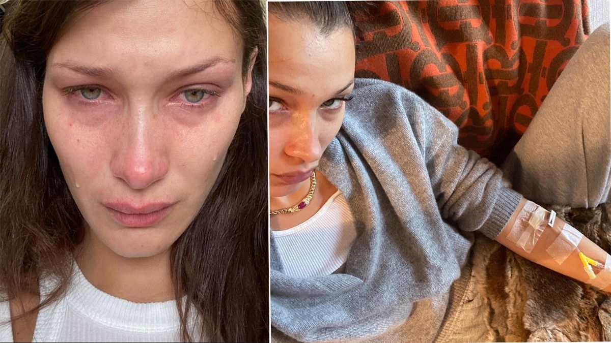 Bella Hadid mierzy się z ogromną traumą. Zrozpaczona wszystko wyznała na Instagramie. Wpis opatrzyła serią przejmujących zdjęć
