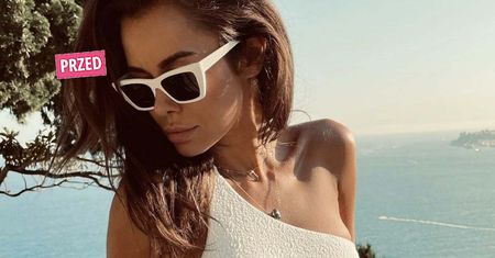 Co się stało z twarzą Natalii Siwiec? W Ameryce przeszła sporą przemianę. Zmiany widać z oddali