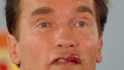 Arnold Schwarzenegger po wypadku