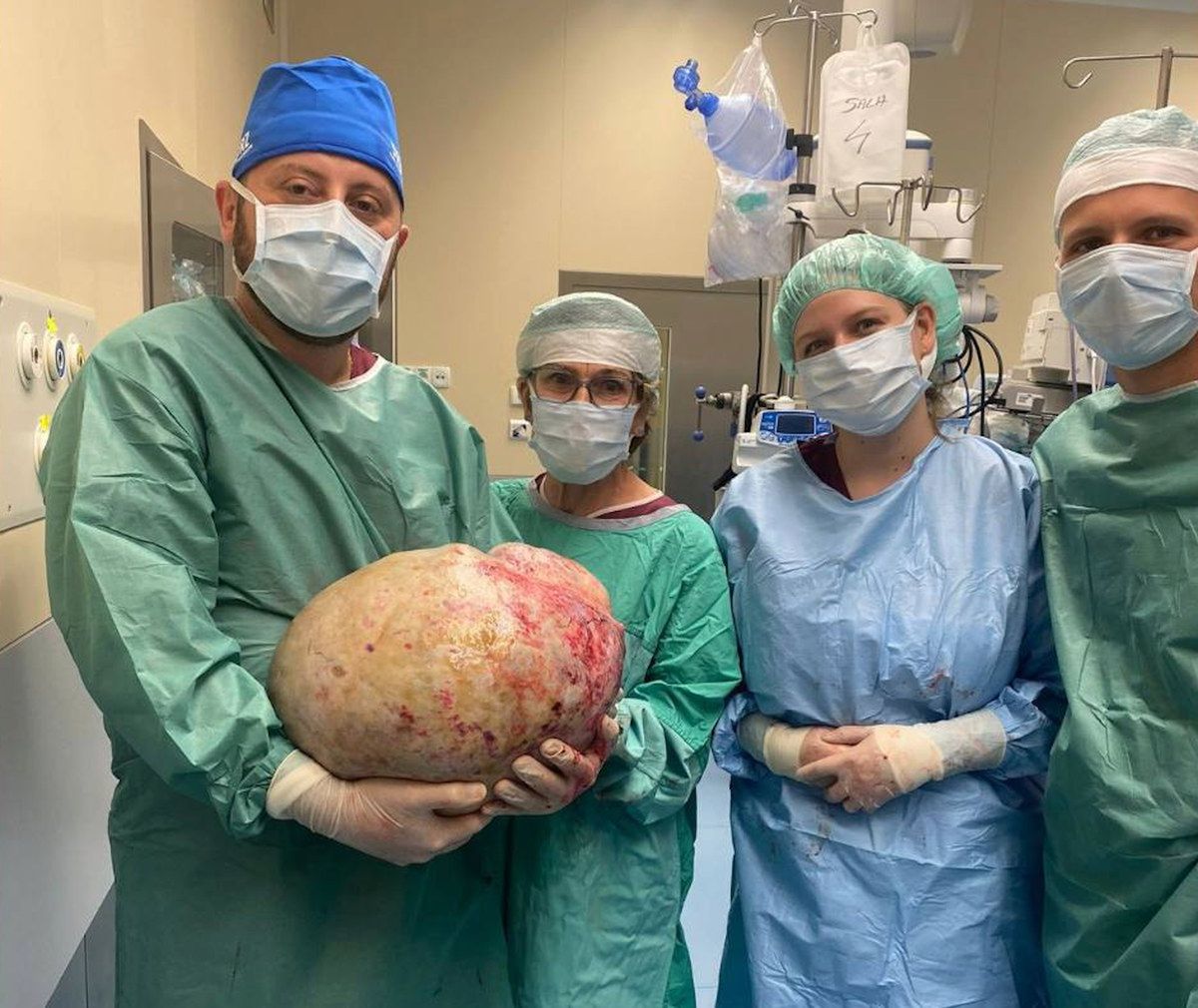 W Elblągu lekarze przeprowadzili trudną operację usunięcia 20-kilogramowego guza jajnika