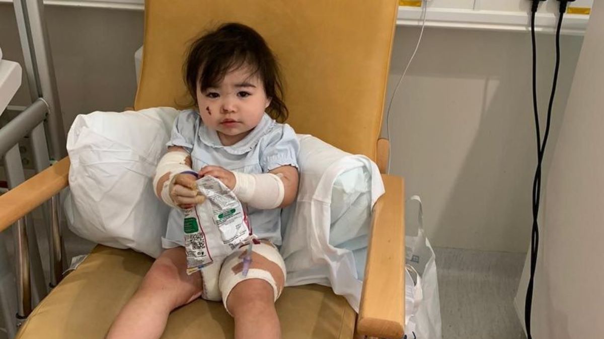 Dziewczynka poparzyła się sosem z KFC 