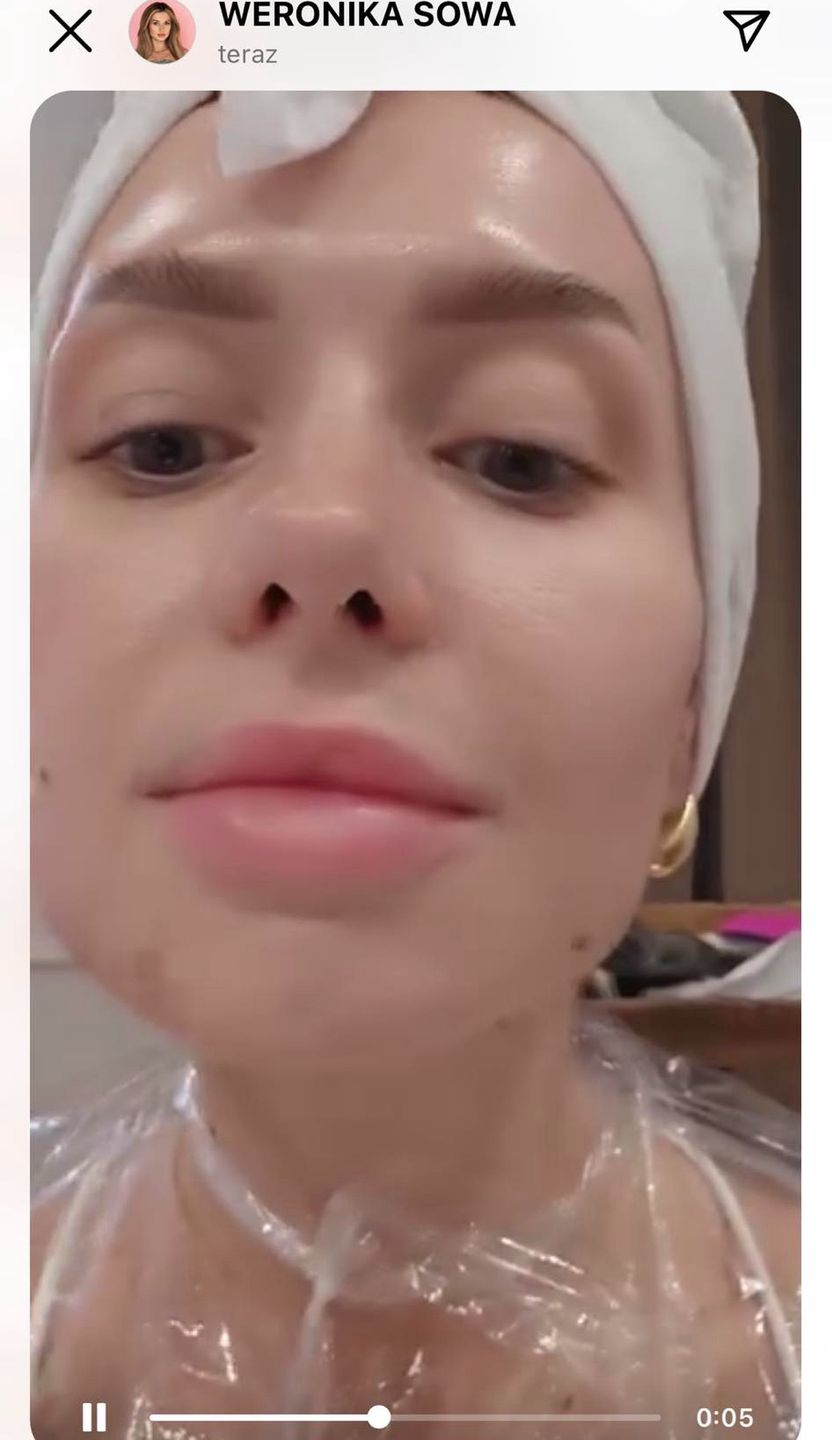 Wersow rozpuściła kwas w ustach