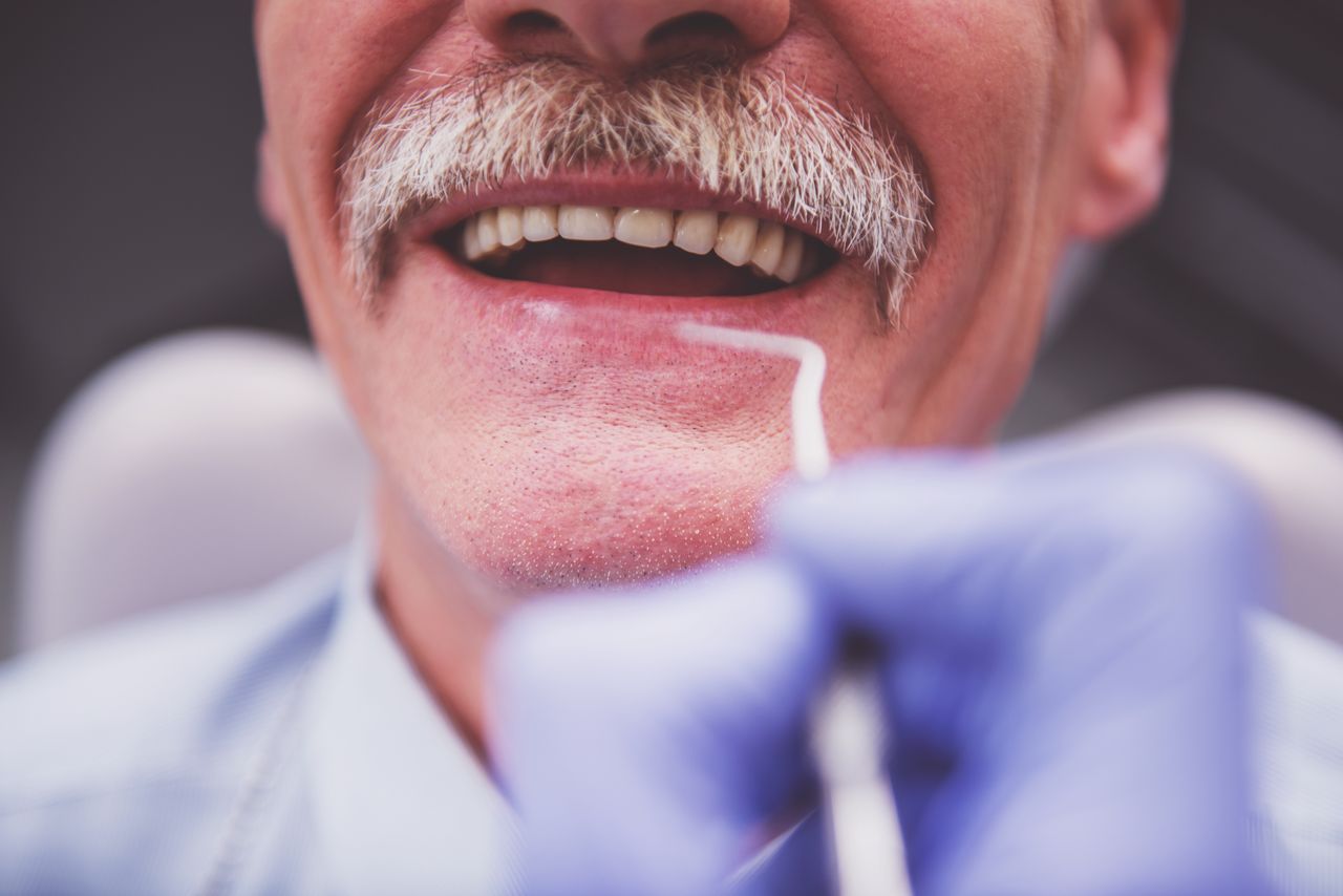 Stan zębów a choroba Alzheimera. Naukowcy odkryli zależność