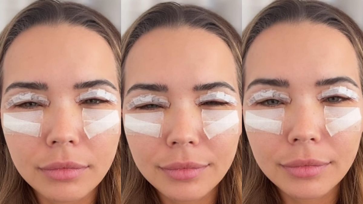 Sandra Kubicka dochodzi do siebie po operacji plastycznej